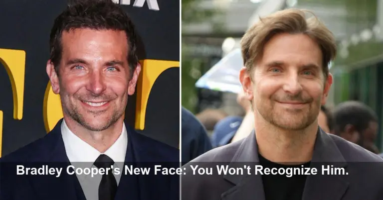 Bradley Cooper's Surgery Disaster Shocks Fans