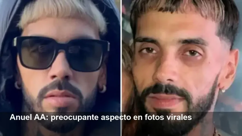 Preocupa la salud de Anuel AA tras fotos virales y rumores